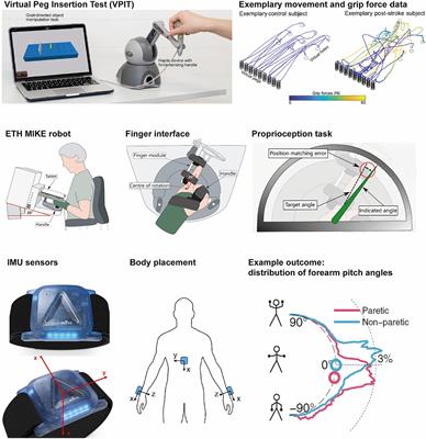 Upper limb sensorimotor recovery in Asian stroke survivors: a study protocol for the development and implementation of a Technology-Assisted dIgitaL biOmaRker (TAILOR) platform